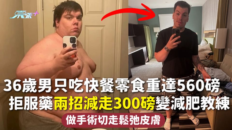 減肥故事 | 36歲男只吃快餐零食重達560磅 拒服藥兩招減走300磅變減肥教練 做手術切走鬆弛皮膚