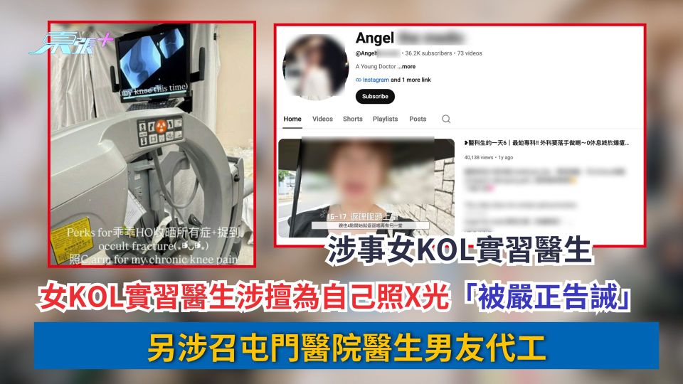 女KOL實習醫生涉擅為自己照X光「被嚴正告誡」　另涉召屯門醫院醫生男友代工