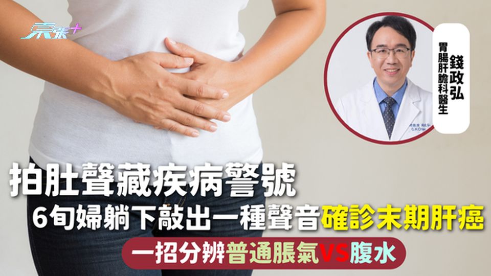 肝癌 | 拍肚聲藏疾病警號 6旬婦躺下敲出一種聲音 確診末期肝癌 一招分辨普通脹氣VS腹水