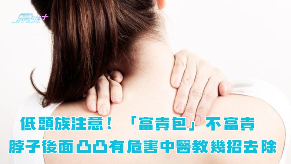 低頭族注意！「富貴包」不富貴 脖子後面凸凸有危害中醫教幾招去除