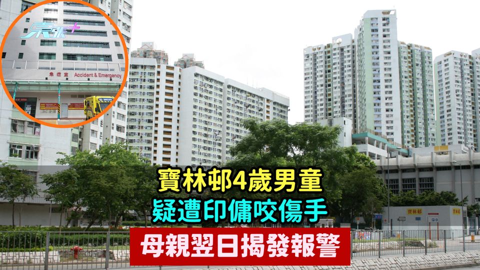 寶林邨4歲男童疑遭印傭咬傷手  母親翌日揭發報警