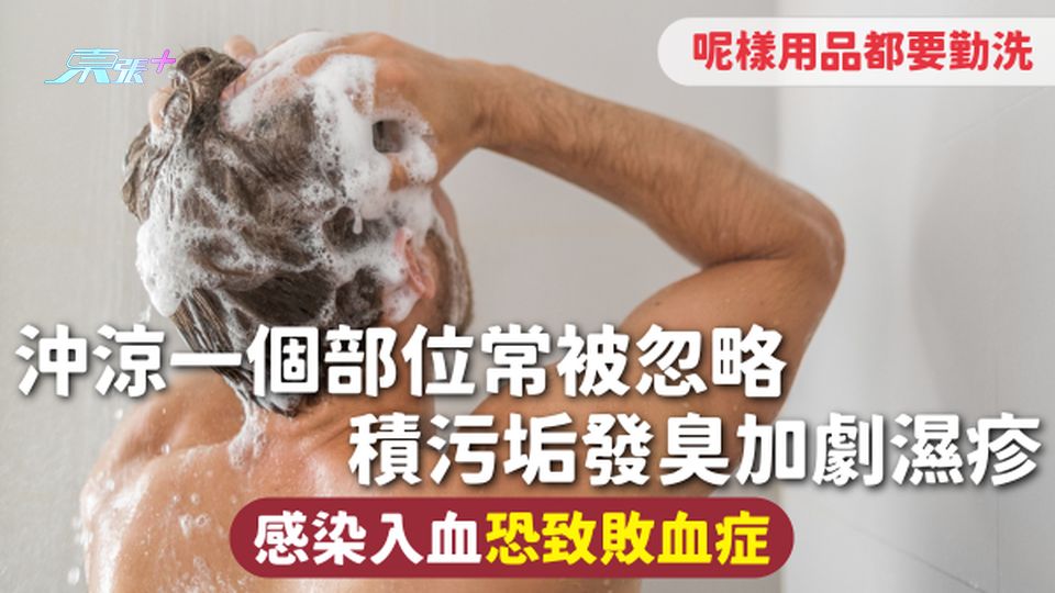 洗澡注意 | 沖涼一個部位常被忽略 積污垢發臭加劇濕疹 感染入血恐致敗血症 呢樣用品都要勤洗