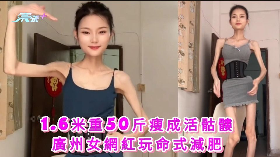 有片｜1.6米重50斤瘦成活骷髏 廣州女網紅稱繼續減 網民：行走的骨頭