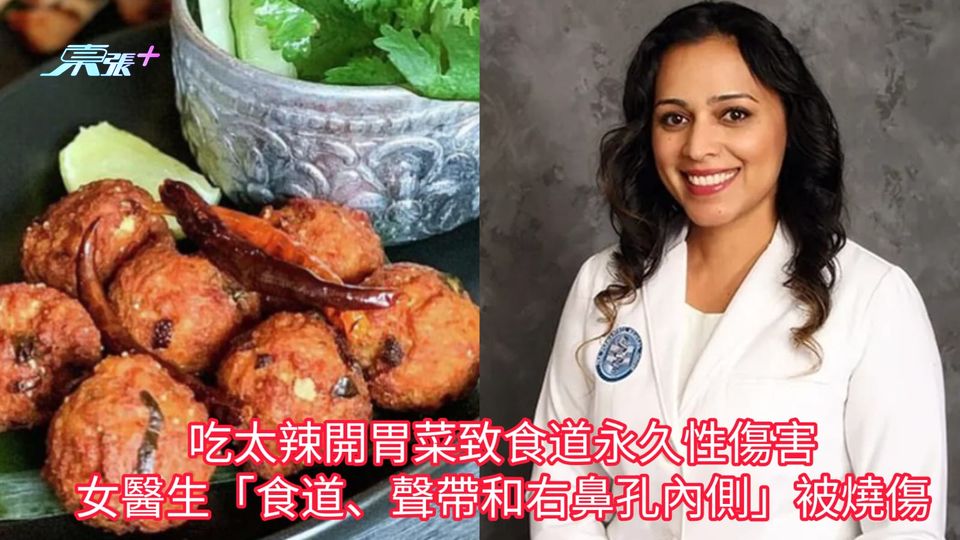 吃太辣開胃菜致食道永久性傷害 女醫生「食道、聲帶和右鼻孔內側」被燒傷