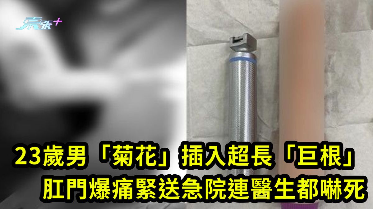 23歲男「菊花」插入超長「巨根」 肛門爆痛緊送急院連醫生都嚇死