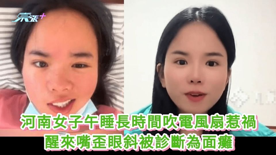 河南女子午睡長時間吹電風扇惹禍 醒來嘴歪眼斜被診斷為面癱
