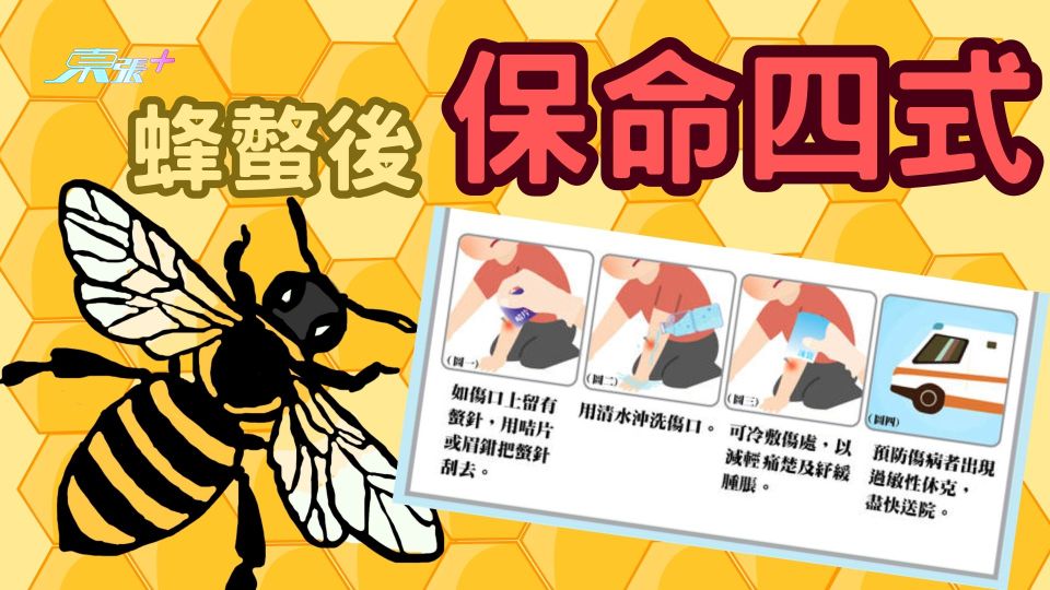 一文看清｜蜂螫後保命四式 做到呢樣死亡率大幅下降！