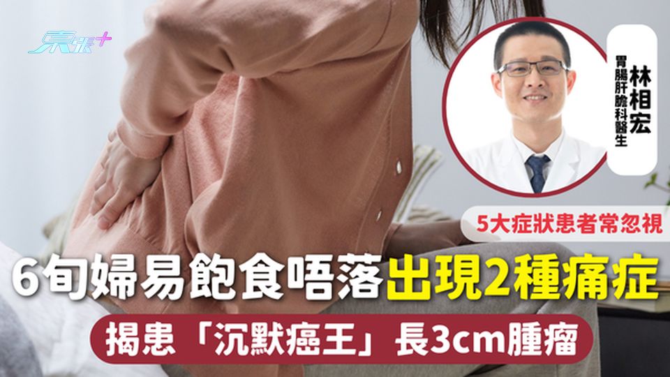 胰臟癌 | 6旬婦易飽食唔落 出現2種痛症 揭患「沉默癌王」長3cm腫瘤 留意5大症狀患者常忽視