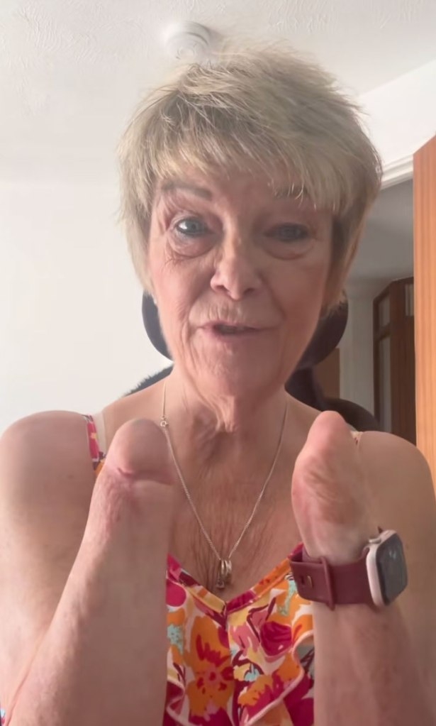 手臂縮短的女人，展示她的手臂並對鏡頭說話。