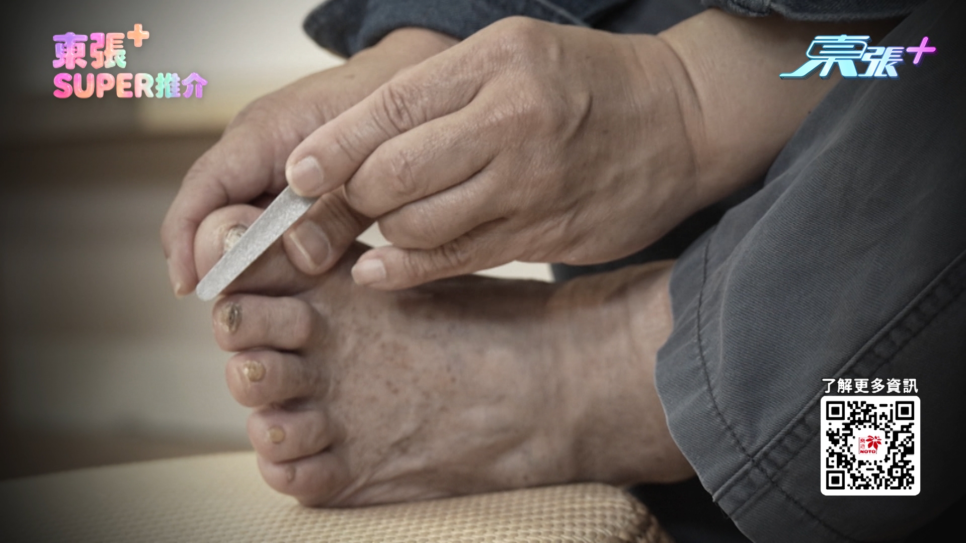 灰甲問題真的令人頭痕！別以為灰甲好易K.O.，可能用上半年都還未搞好？最初鄒先生見到「腳趾公」又黃又厚，「無諗過係灰甲，但過多排，第二、三隻腳趾都變黃​，嗰下先知係灰甲，仲會傳染」。