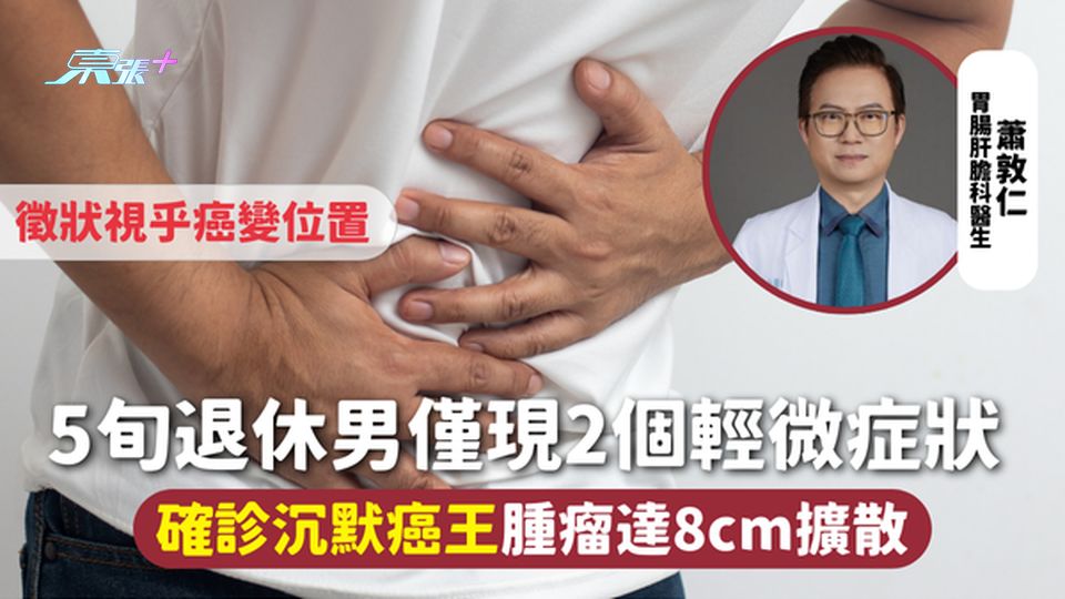 胰臟癌 | 5旬退休男僅現2個輕微症狀 確診沉默癌王 腫瘤達8cm擴散 徵狀視乎癌變位置