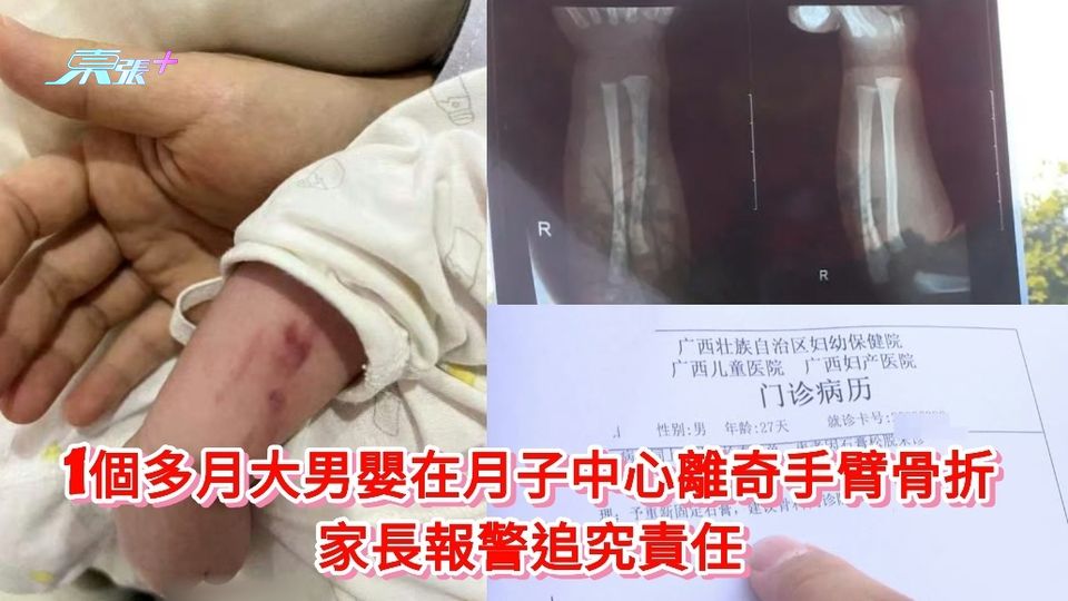 男嬰在月子中心離奇手臂骨折 家長報警追究責任