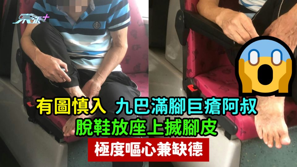 有圖慎入 | 九巴滿腳巨瘡阿叔脫鞋放座上搣腳皮  極度嘔心兼缺德　