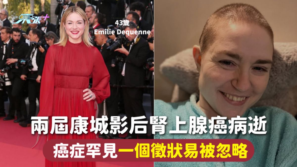 腎上腺癌 | 兩屆康城影后腎上腺癌病逝 癌症罕見一個徵狀易被忽略