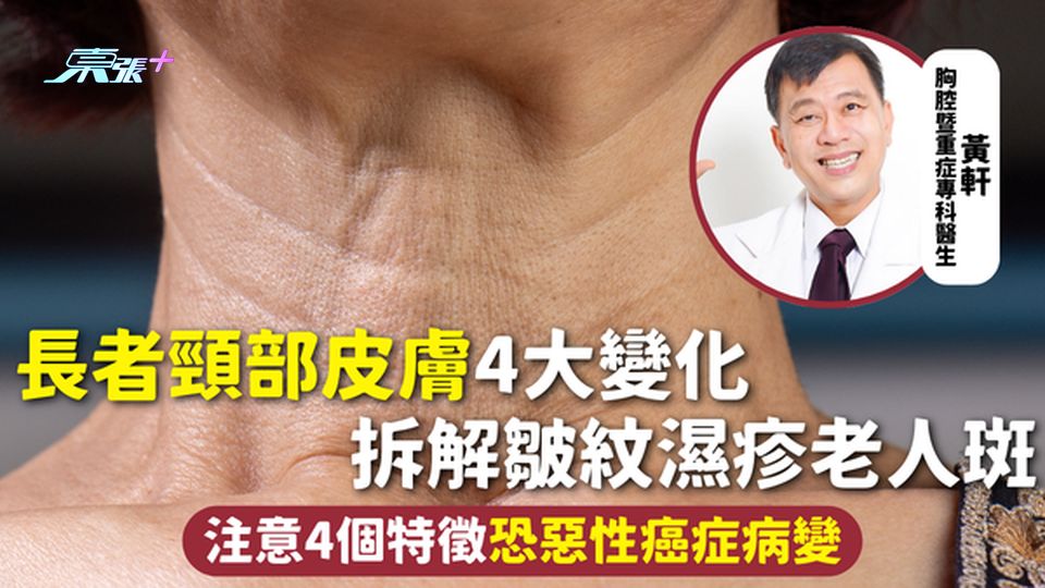 長者皮膚 | 長者頸部皮膚4大變化 拆解皺紋濕疹老人斑 注意4個特徵恐惡性癌症病變