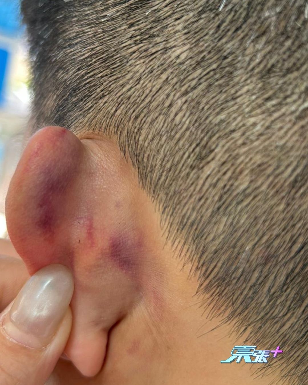 筲箕灣MMA｜員工慘被狂毆　今回應「東張+」已報警　事主：今日又嘔又暈