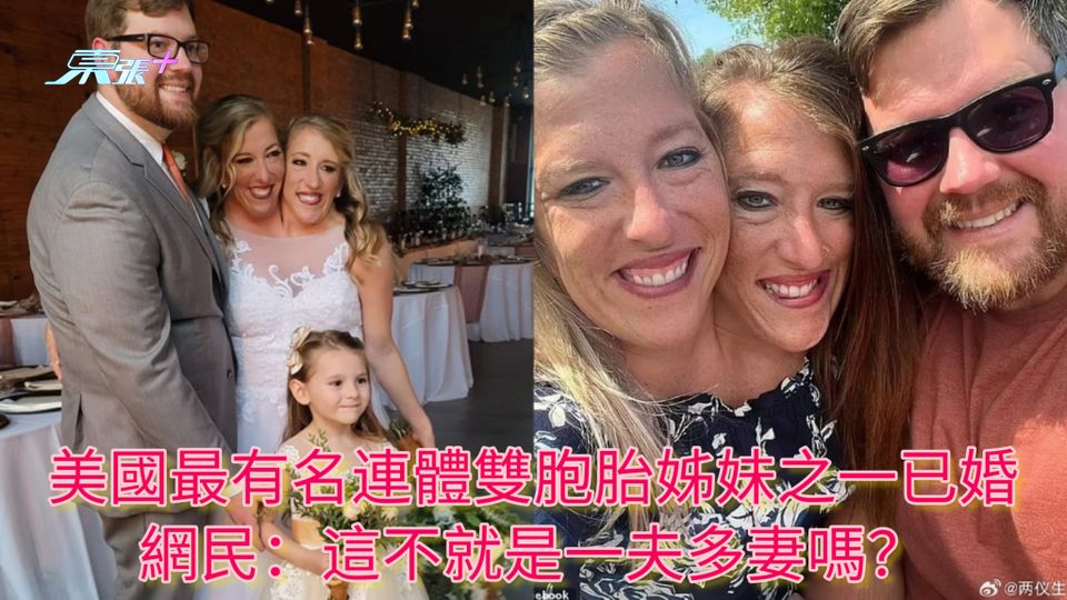 美國最有名連體雙胞胎姊妹之一已婚 網民：這不就是一夫多妻嗎？