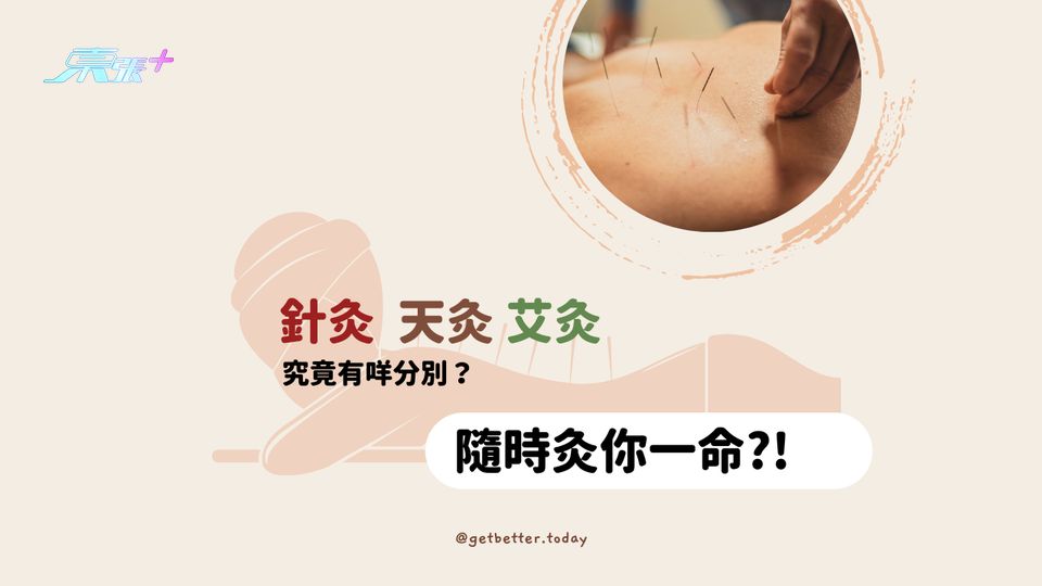 針灸 天灸 艾灸 隨時「灸」你一命！ #至識健康