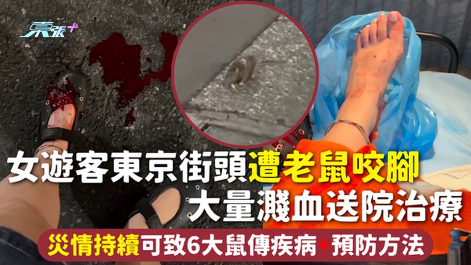 遊日注意 | 女遊客東京街頭遭老鼠咬腳 大量濺血送院治療 災情持續可致6大鼠傳疾病+預防方法