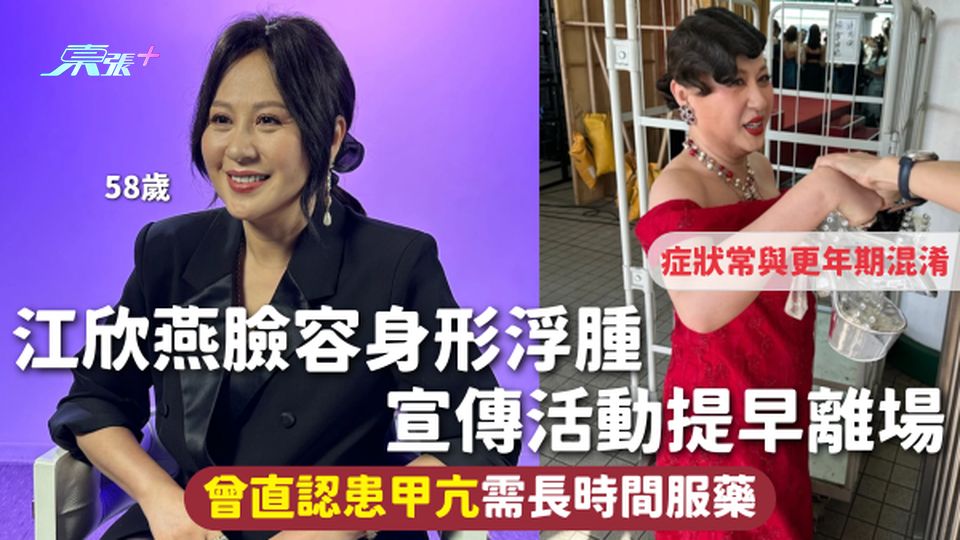 名人健康 | 江欣燕臉容身形浮腫 宣傳活動提早離場 曾直認患甲亢需長時間服藥 症狀常與更年期混淆