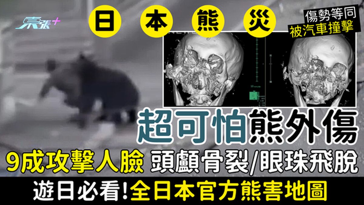 日本熊灾｜超可怕「熊外伤」 日本医生：9成攻击人脸 头颅骨爆裂/眼球飞脱 游日必看官方熊害地图