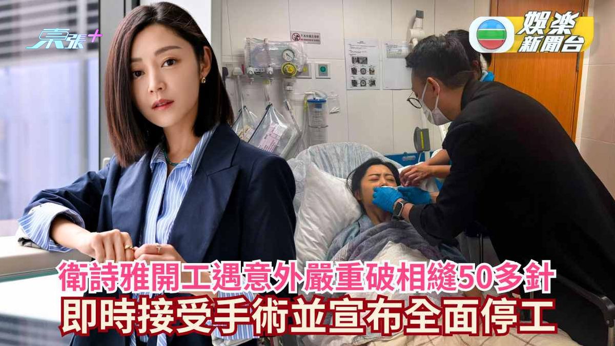 衛詩雅開工遇意外嚴重破相縫50多針 即時接受手術並宣布全面停工