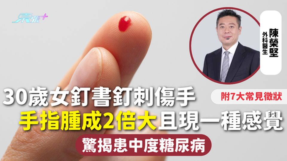 糖尿病 | 30歲女釘書釘刺傷手 手指腫成2倍大且現一種感覺 驚揭患中度糖尿病 附7大常見徵狀