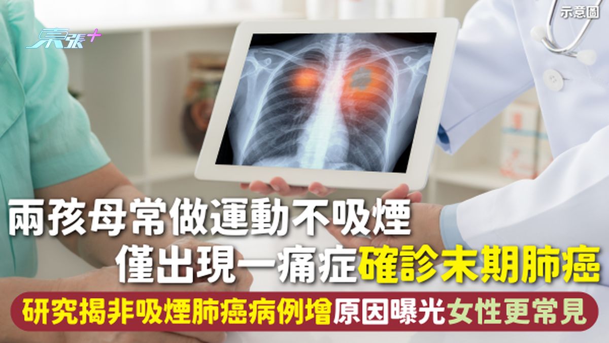 肺癌 | 两孩母常做运动不吸烟 仅出现一痛症确诊末期肺癌 研究揭非吸烟肺癌病例增原因曝光 女性更常见