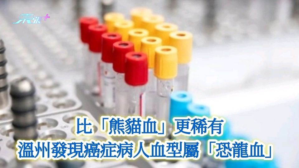 比「熊貓血」更稀有 溫州發現癌症病人血型屬「恐龍血」