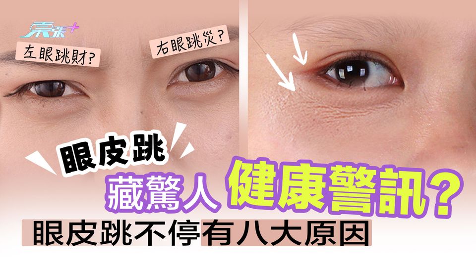 眼皮跳藏驚人健康警訊？眼皮跳不停有八原因 