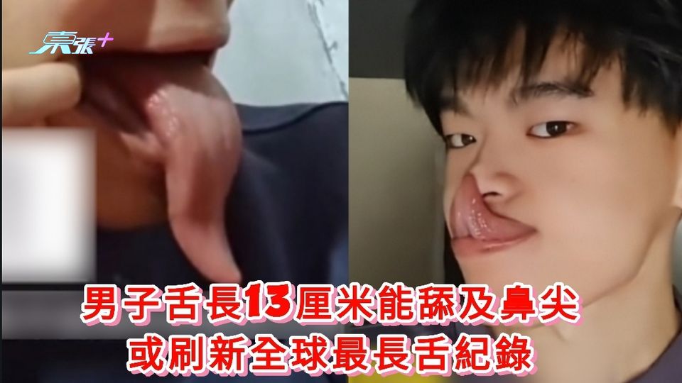 有片丨男子舌長13厘米能舔及鼻尖 或刷新全球最長舌紀錄