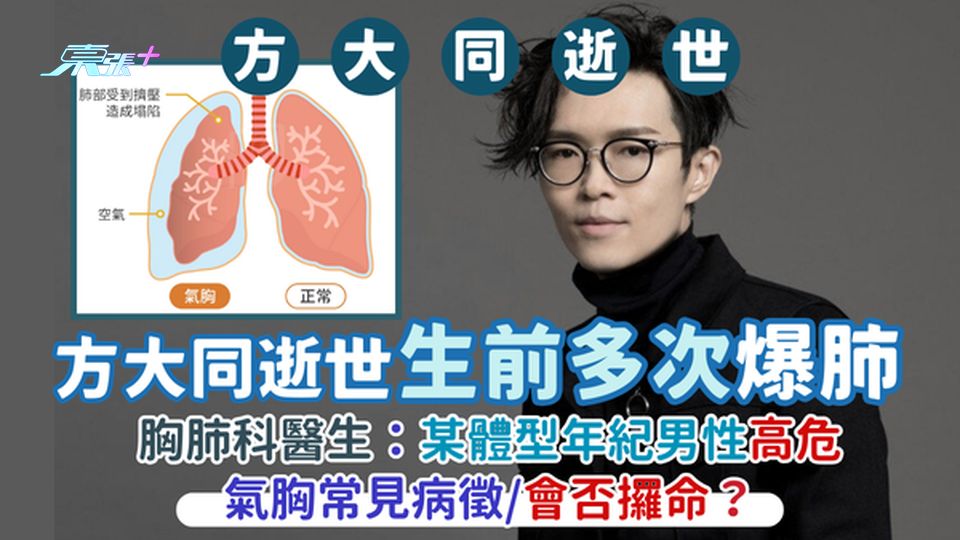 方大同逝世｜生前多次爆肺🫁 胸肺科醫生👩🏻‍⚕️：某體型年紀男性高危/氣胸常見病徵😷會否攞命