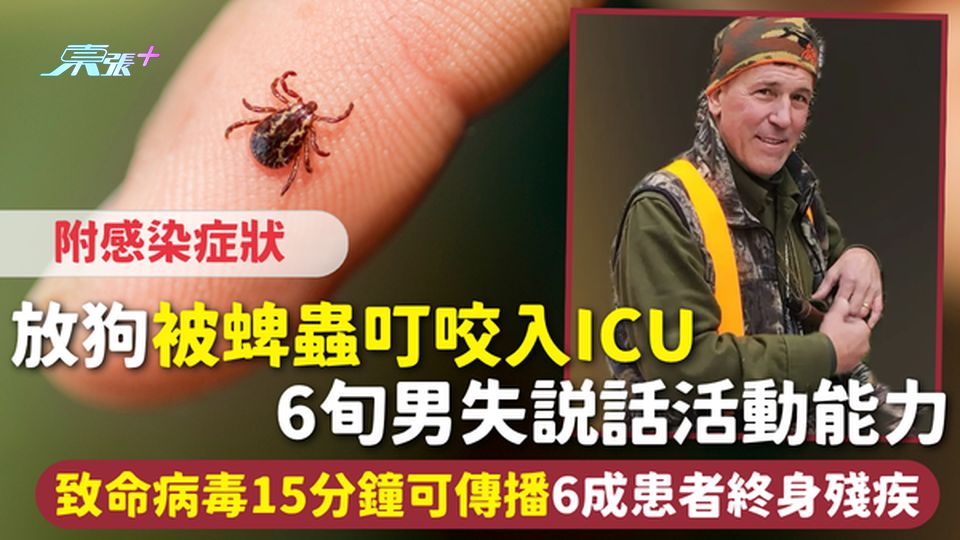 蜱蟲病｜放狗被蜱蟲叮咬入ICU 6旬男失說話活動能力 致命病毒15分鐘可傳播6成患者終身殘疾附症狀