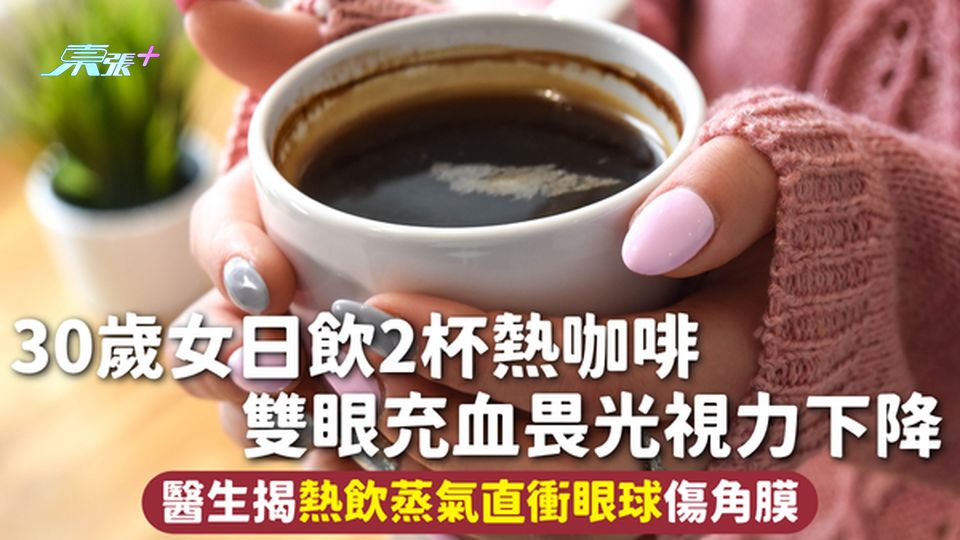 眼睛健康 | 30歲女日飲2杯熱咖啡 雙眼充血畏光視力下降 醫生揭熱飲蒸氣直衝眼球傷角膜