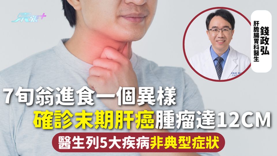 肝癌 | 7旬翁進食一個異樣 確診末期肝癌腫瘤達12cm 醫生列5大疾病非典型症狀