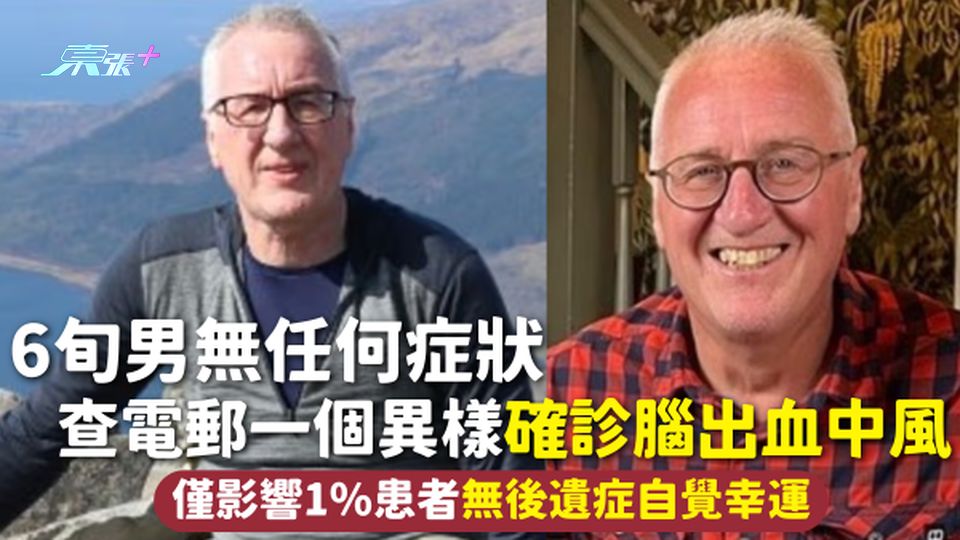 中風 | 6旬男無任何症狀 查電郵一個異樣確診腦出血中風 僅影響1%患者無後遺症自覺幸運