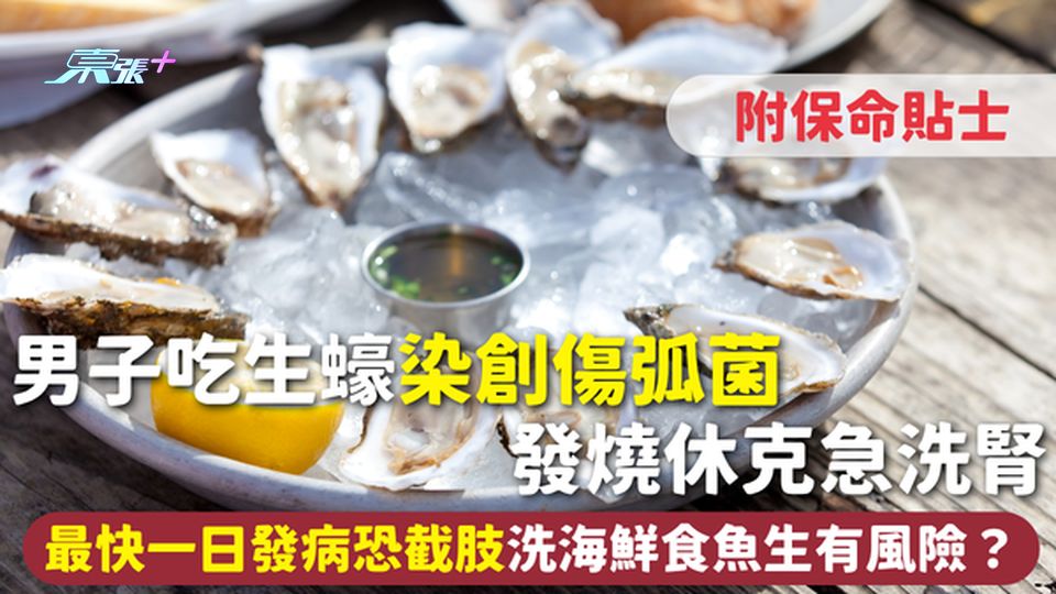 細菌感染｜男子吃生蠔染創傷弧菌 發燒休克急洗腎 最快一日發病恐截肢 洗海鮮食魚生有風險？ 附保命貼士