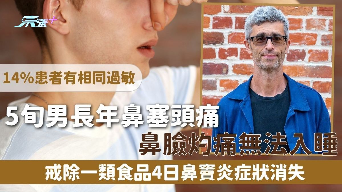 鼻竇炎｜5旬男長年鼻塞頭痛 鼻臉灼痛無法入睡 戒除一類食品4日 鼻竇炎症狀消失 14%患者有相同過敏