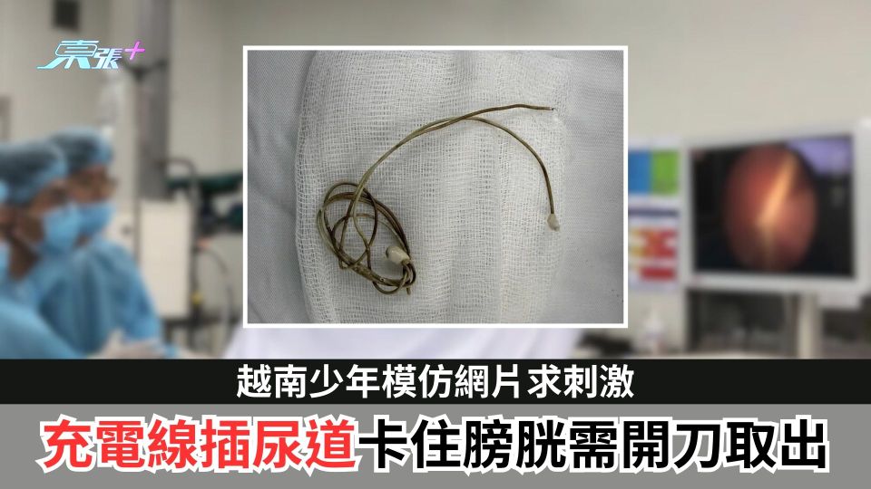 越南少年模仿網片求刺激　充電線插尿道卡住膀胱需開刀取出