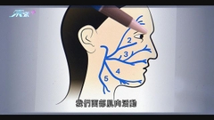 貝爾氏麻痺由腦幹第七條神經線發炎等引起 發病首72小時為治療黃金時間