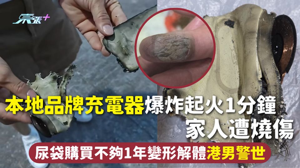 充電器安全 | 本地品牌充電器爆炸起火1分鐘 家人遭燒傷 尿袋購買不夠1年變形解體 港男警世