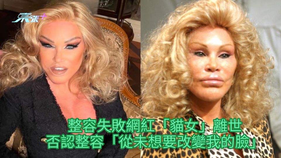 整容失敗網紅「貓女」離世 否認整容「從未想要改變我的臉」