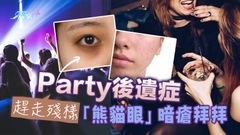 節日後遺症 趕走殘樣「熊貓眼」暗瘡拜拜