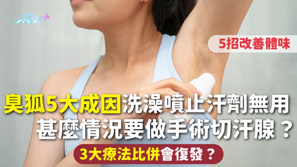 臭狐 | 5大成因 洗澡噴止汗劑無用 5招改善體味 甚麼情況要做手術切汗腺？3大療法比併會復發？