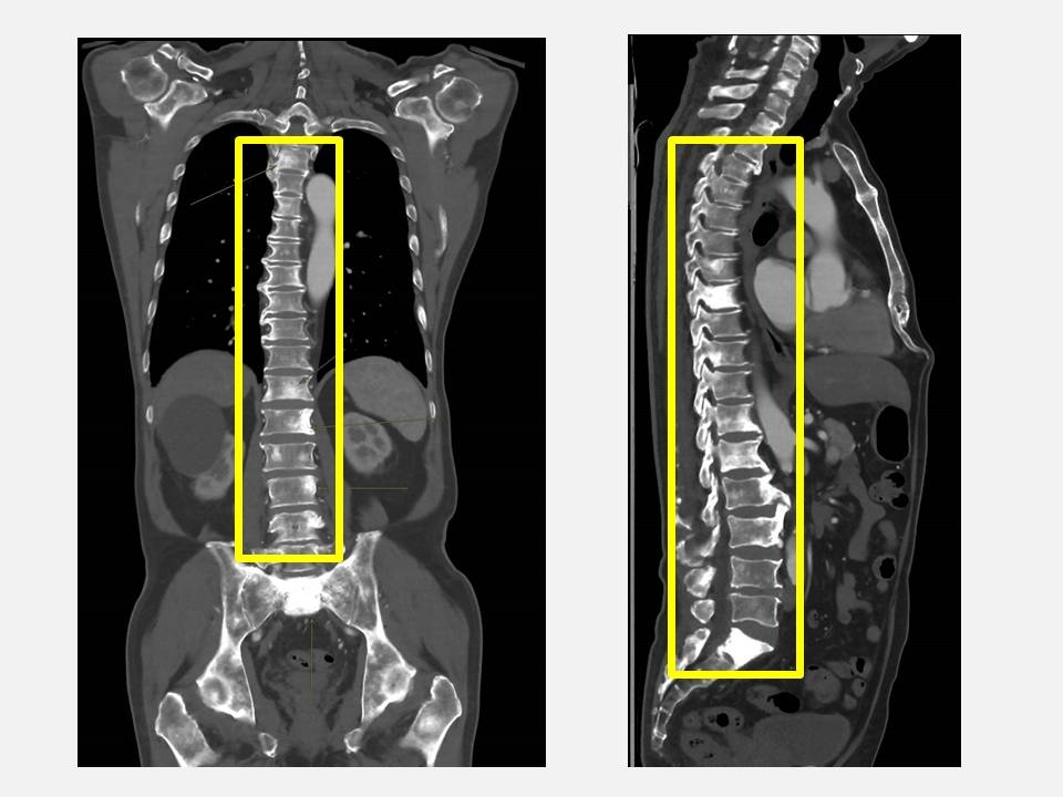 May be an image of ‎bone, xray and ‎text that says '‎ا‎'‎‎