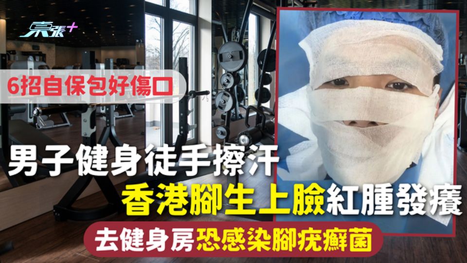 真菌感染｜男子健身徒手擦汗 香港腳生上臉紅腫發癢 去健身房恐感染腳疣癬菌 6招自保包好傷口