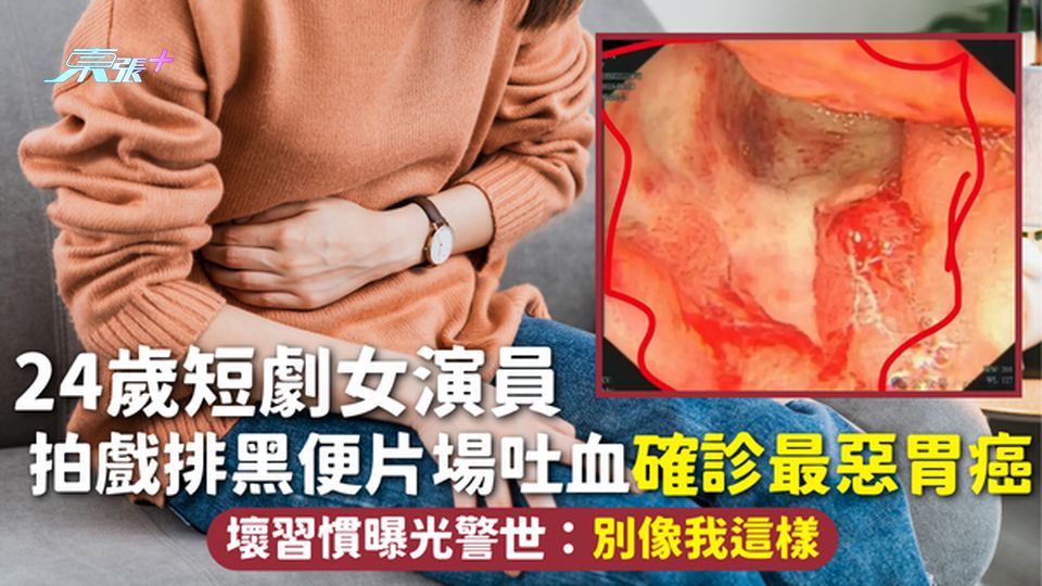 胃癌 | 24歲短劇女演員拍戲排黑便片場吐血 確診最惡胃癌 壞習慣曝光警世：別像我這樣