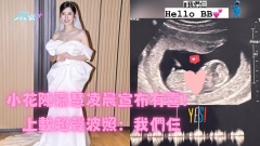 小花陳嘉慧凌晨宣布有喜！上載超聲波照：我們仨