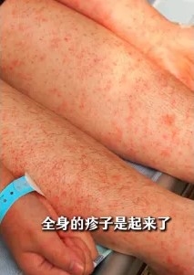 文中亦向區內民眾提醒進行各項防疫措施。