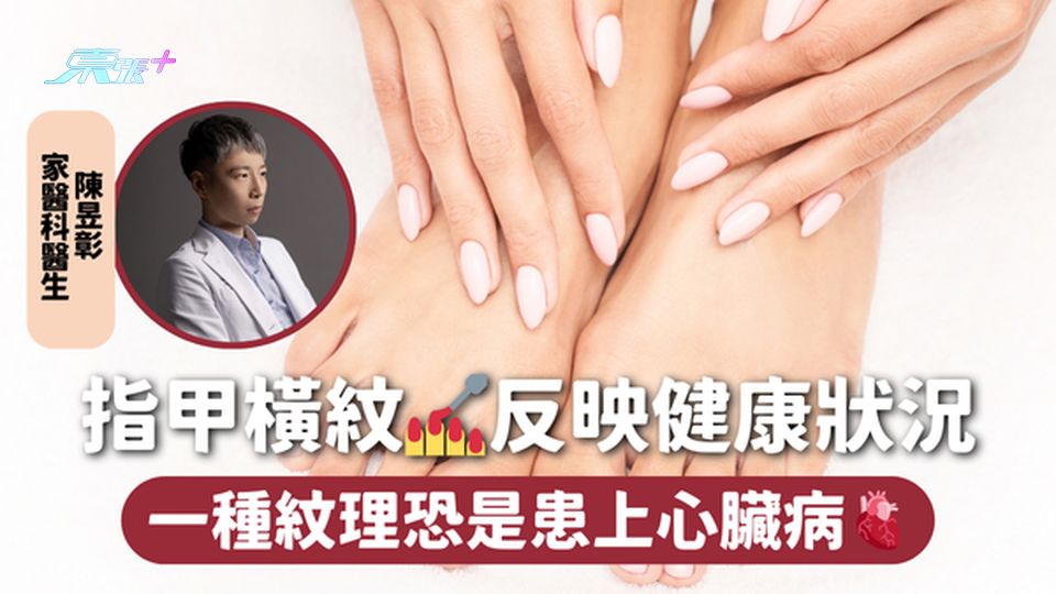 指甲橫紋💅反映健康狀況 一種紋理恐是患上心臟病🫀